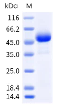 Sino Biological Mouse ROR2 Protein 1MG (Sino Biological), Quantity: Each