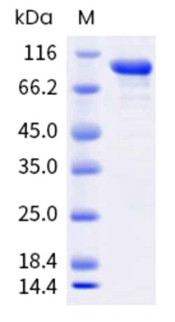 Sino Biological Mouse HK2 Protein 50ug (Sino Biological), Quantity: Each