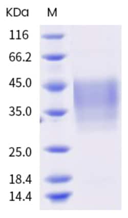 Sino Biological Mouse TREM-1 Protein (ECD, His Tag) 1mg, Quantity: Each