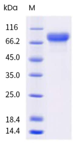 Sino Biological Mouse PROS1 Protein 100ug (Sino Biological), Quantity: