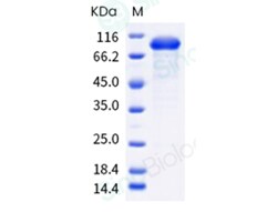 Sino Biological Recombinant Mouse ROR1 Protein (hFc Tag), HPLC-verified,