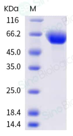 Sino Biological Recombinant Mouse ROR1 Protein (His Tag), HPLC-verified,