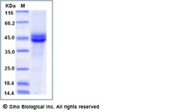 Sino Biological Mouse PLA2G2D / Phospholipase A2 IID Protein (Fc Tag) 100ug,