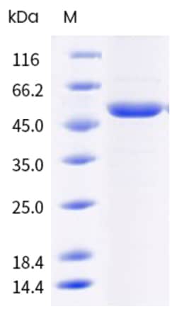 Sino Biological Mouse Tssk3 Protein 20ug (Sino Biological), Quantity: Each