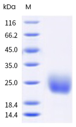 Sino Biological Mouse PSCA Protein 1MG (Sino Biological), Quantity: Each