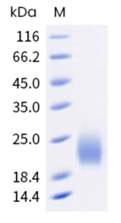 Sino Biological Mouse PSCA Protein 20ug (Sino Biological), Quantity: Each