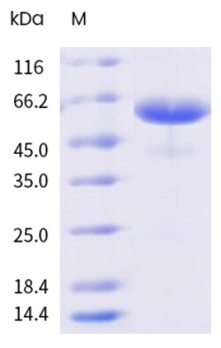 Sino Biological Recombinant Mouse IGSF11 Protein (hFc Tag), HPLC-verified
