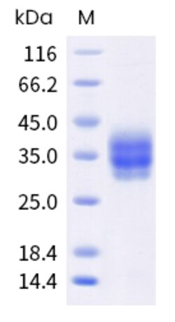 Sino Biological Mouse TNFRSF9 Protein 100ug (Sino Biological), Quantity: