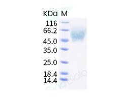 Sino Biological Recombinant Mouse 5T4/TPBG Protein (His Tag), HPLC-verified,