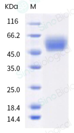 Sino Biological Recombinant Chinese hamster Phospholipase A2 group XV/PLA2G15