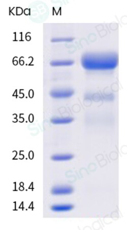 Sino Biological Chinese hamster PLBD2 Protein (His Tag) 100ug, Quantity: