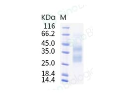 Sino Biological Recombinant Chinese hamster Clusterin Protein (His Tag),