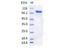 Sino Biological Recombinant Mouse Nectin-4 Protein (ECD, hFc Tag), Quantity: