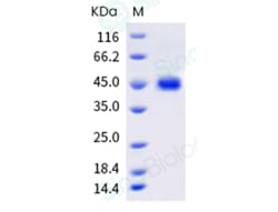 Sino Biological Recombinant Mouse Nectin-4 Protein (ECD, His Tag), Quantity: