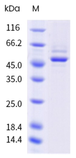 Sino Biological&nbsp;Recombinant Mouse TRIM21 Protein (His Tag) 100