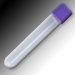 Globe Scientific Screwcap Sample Tubes, Non-Graduated Round | Buy Online | Globe Scientific | Fisher Scientific