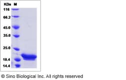 Sino Biological Sus scrofa (pig) IL6 / IL-6 Protein 20ug, Quantity: Each