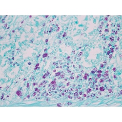 Marketlab, Inc.&nbsp;Acid Fast Bacteria (AFB) Animal Pos