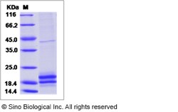 Sino Biological Recombinant Rabbit IL-17A Protein (His Tag), Quantity: