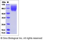 Sino Biological Recombinant Rabbit TrkA Protein (His Tag), HPLC-verified,