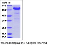 Sino Biological Rabbit NGFR / TNFRSF16 / P75 Protein (ECD, Fc Tag) 50ug,