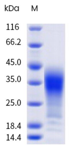 Sino Biological&nbsp;Recombinant Rabbit IL-13 Protein (His Tag), HPLC-verified 1