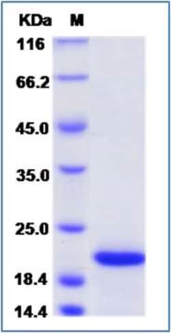 Sino Biological Asp f 1 Protein 50ug (Sino Biological), Quantity: Each