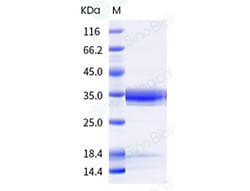 Sino Biological Recombinant Human B7-1/CD80 Protein (ECD, hFc Tag), HPLC-verified,