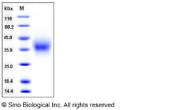 Sino Biological Recombinant Canine TIM-1/HAVCR1 Protein (His Tag), HPLC-verified,