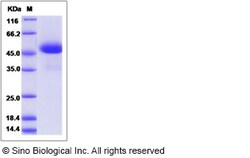 Sino Biological Canine WAP5 / WFDC2 / HE4 Protein (Fc Tag) 100ug, Quantity: