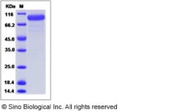 Sino Biological Recombinant Canine Her2/ERBB2 Protein (His Tag), HPLC-verified,