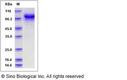 Sino Biological Canine Carbonic Anhydrase IX / CA9 Protein (Fc Tag) 20ug,