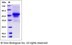Sino Biological Recombinant Canine Carbonic Anhydrase IX/CA9 Protein (His