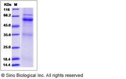 Sino Biological Recombinant Canine Angiopoietin-like 7 Protein (hFc Tag),