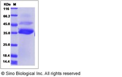 Sino Biological Recombinant Canine Angiopoietin-like 7 Protein (His Tag),