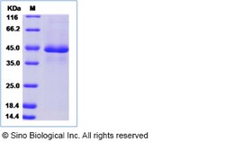 Sino Biological Recombinant Canine PDGF-A Protein (hFc Tag), Quantity: