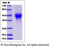 Sino Biological Canine CXCL16 / SR-PSOX Protein (His Tag) 50ug, Quantity: