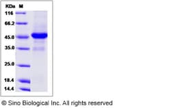 Sino Biological Recombinant Canine CD40 Ligand/TNFSF5 Protein (mFc Tag),
