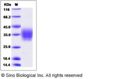 Sino Biological Recombinant Canine Ephrin B2 Protein (His Tag), Quantity: