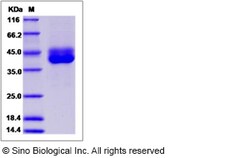 Sino Biological Recombinant Canine IL-13 R alpha 2/IL13RA2 Protein (His