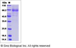 Sino Biological Recombinant Canine IL-20R alpha/IL-20RA Protein (hFc Tag),