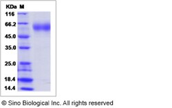 Sino Biological Canine IL18R1 Protein (ECD, His Tag) 100ug, Quantity: Each