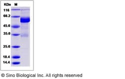 Sino Biological Recombinant Canine IL22RA1 Protein (hFc Tag), Quantity: