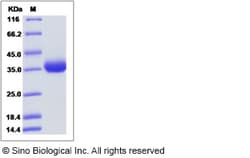 Sino Biological Canine IL22RA1 / IL22R Protein (His Tag) 100ug, Quantity: