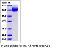Sino Biological Recombinant Canine IL1R2 Protein (hFc Tag), Quantity: Each