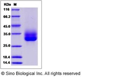 Sino Biological Canine CD137 / 4-1BB / TNFRSF9 Protein (His Tag) 100ug,