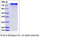 Sino Biological Recombinant Canine IL17RD Protein (hFc Tag), Quantity: