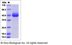 Sino Biological Recombinant Canine CD3 delta/CD3D Protein (hFc Tag), Quantity: