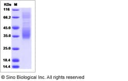 Sino Biological Recombinant Canine PD-1 Protein (His Tag), HPLC-verified,