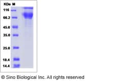 Sino Biological Recombinant Canine PD-L1/B7-H1 Protein (ECD, hFc Tag),